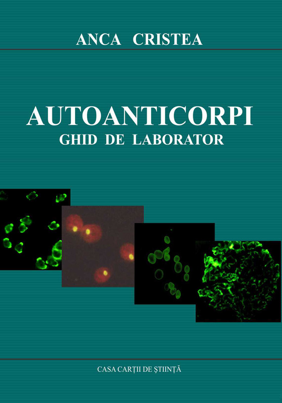 Autoanticorpi. Ghid de laborator