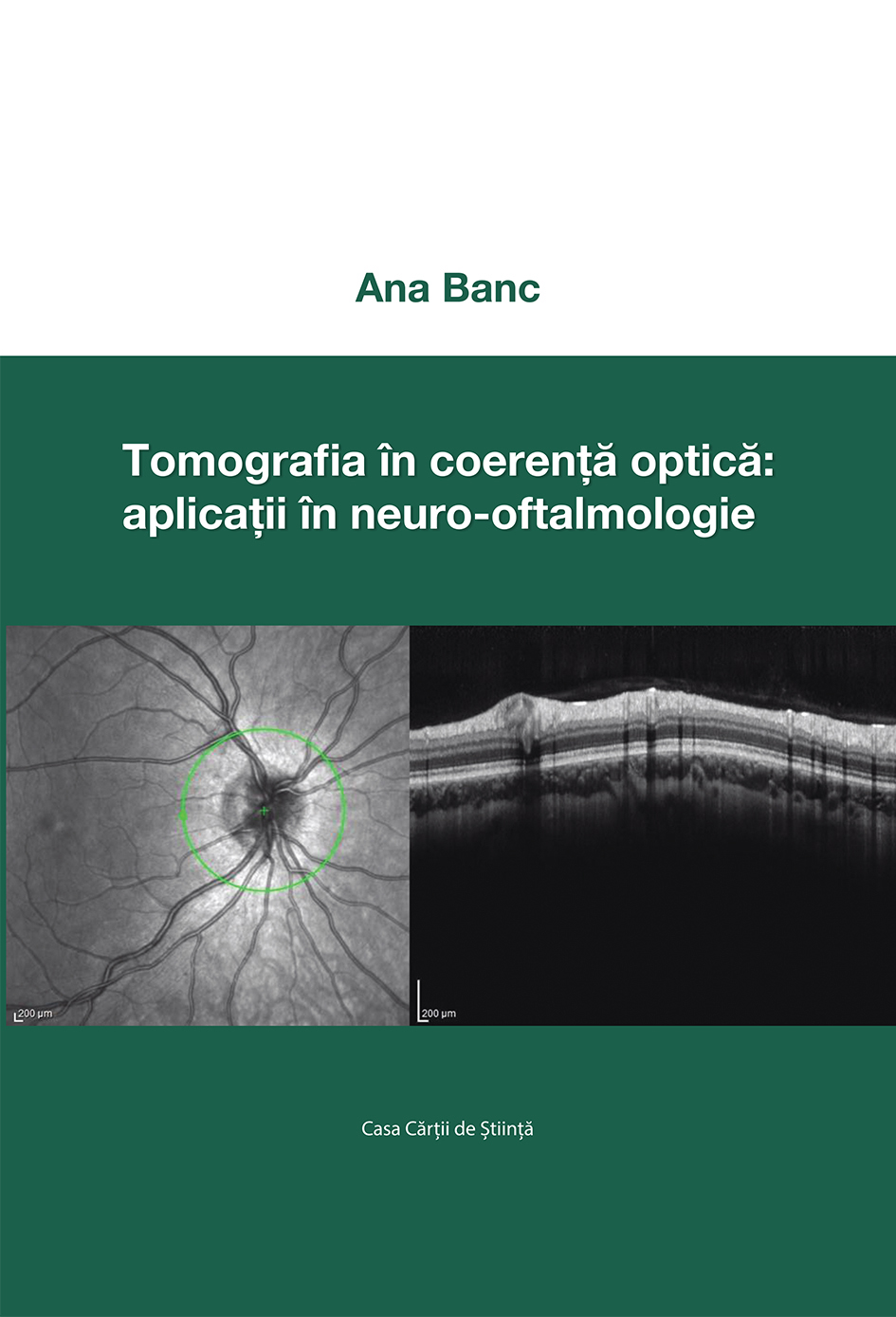 Tomografia în coerență optică: aplicații în neuro-oftalmologie